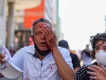 Campelo foi socorrido no Hospital da Restauração, na área central da capital pernambucana.